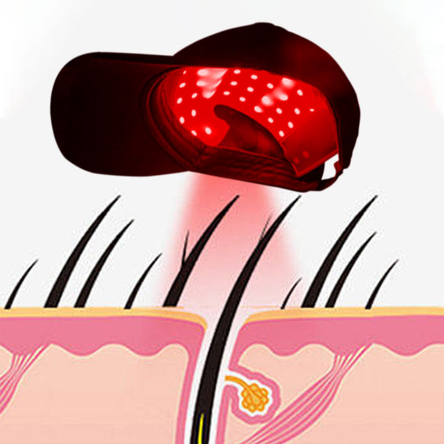 Carina Dual-Wavelength LED Hair Restoration Cap